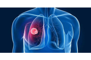 1eVoKmXrrdVYmO40taUc7Iu44lUJZLYj3VdvTXlm