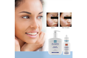 eEGifHfu6QZVvKABcrIVY5BPOm44FpLYiVH6QLD2